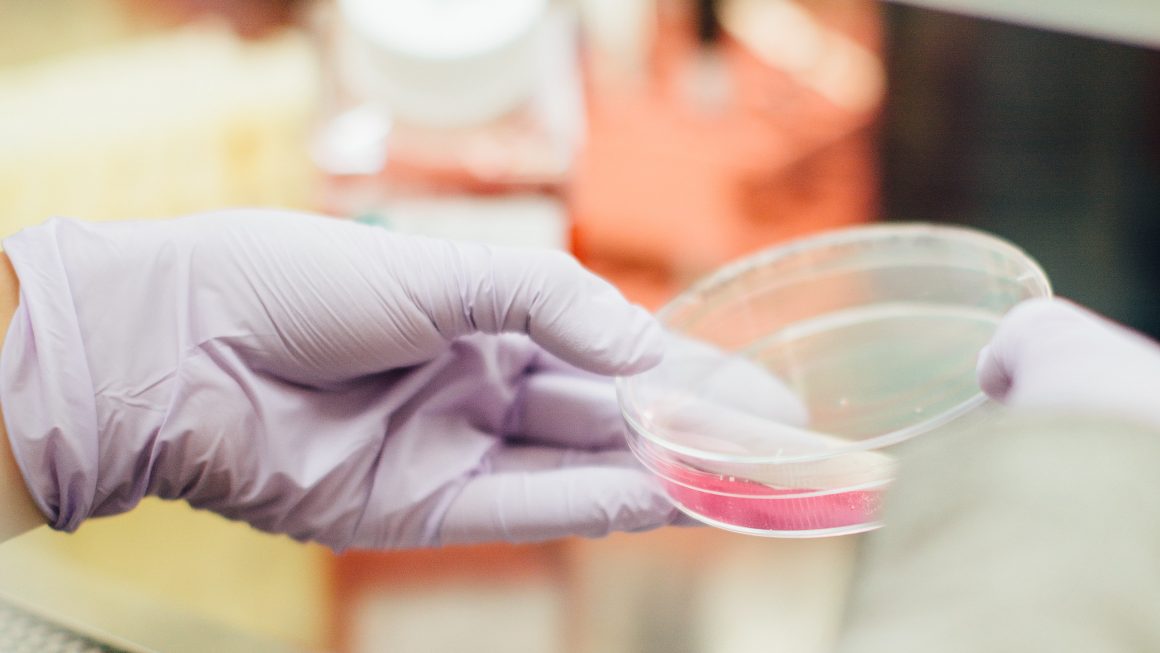 Surface Protein Expression of Circulating Tumor Cells